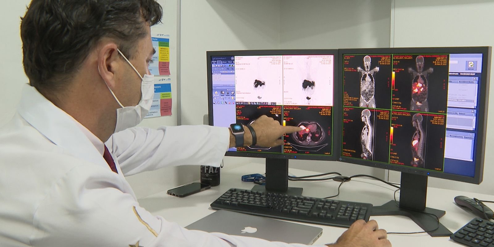 Ministério da Saúde libera R$ 100 milhões para terapia CAR-T Cell