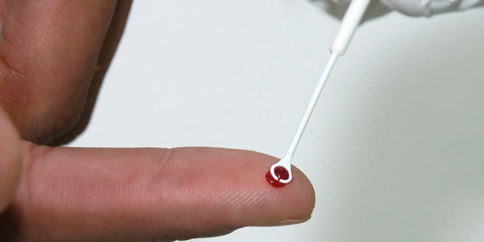 Saúde amplia vacinação contra o HPV