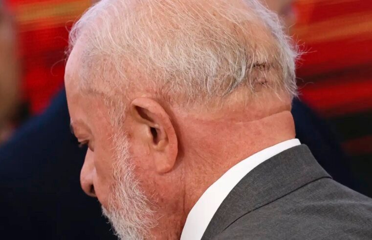 Médico de Lula descarta sequela e diz que função cerebral está intacta
