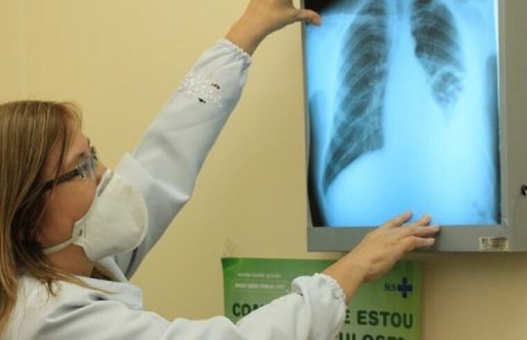 Brasil está na contramão da meta da OMS para extinção da tuberculose