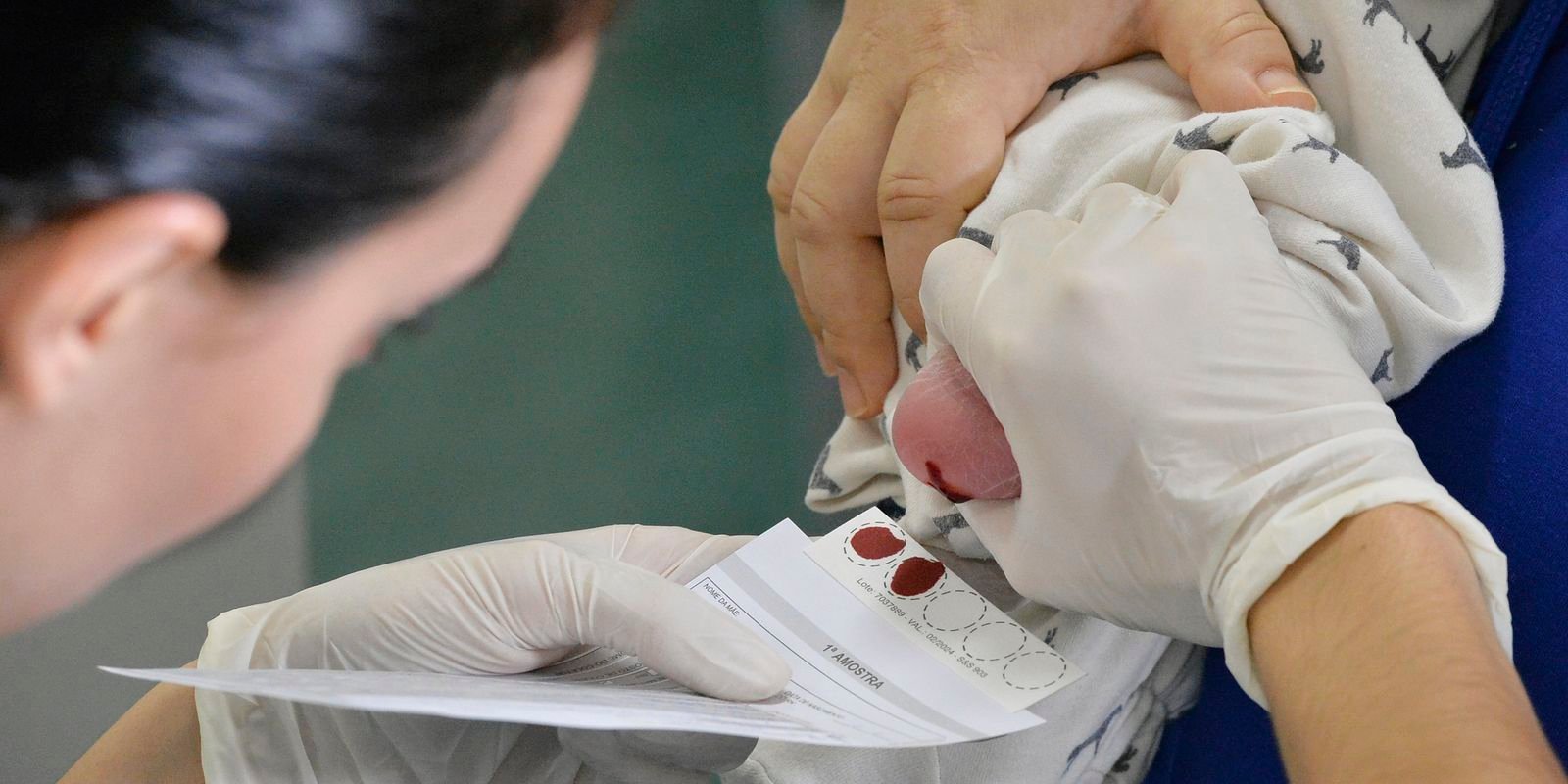 Dia Mundial das Doenças Raras reforça importância do teste do pezinho