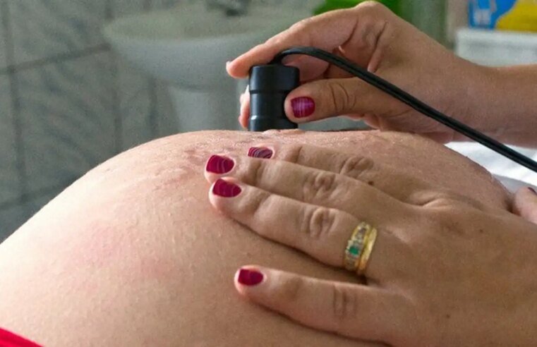 Saúde recomenda cálcio para todas as gestantes para prevenir eclâmpsia