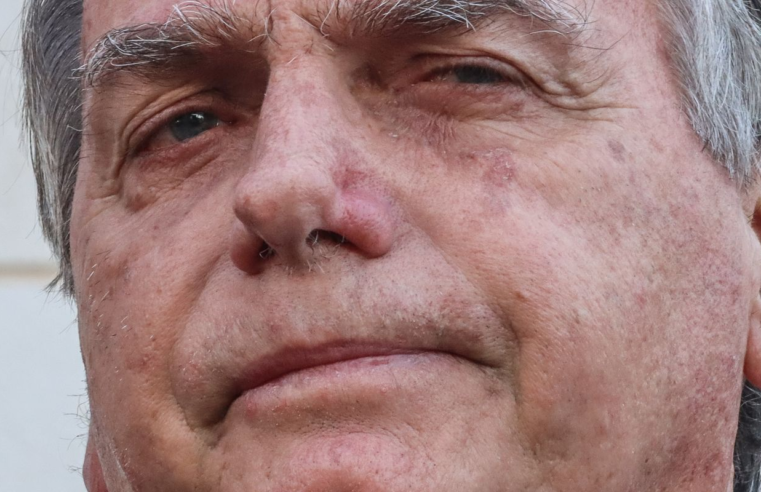 Bolsonaro apresenta piora clínica e vai passar por novos exames