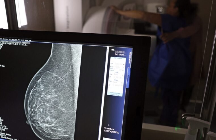 Câncer de mama: uma em cada três pacientes tem menos de 50 anos