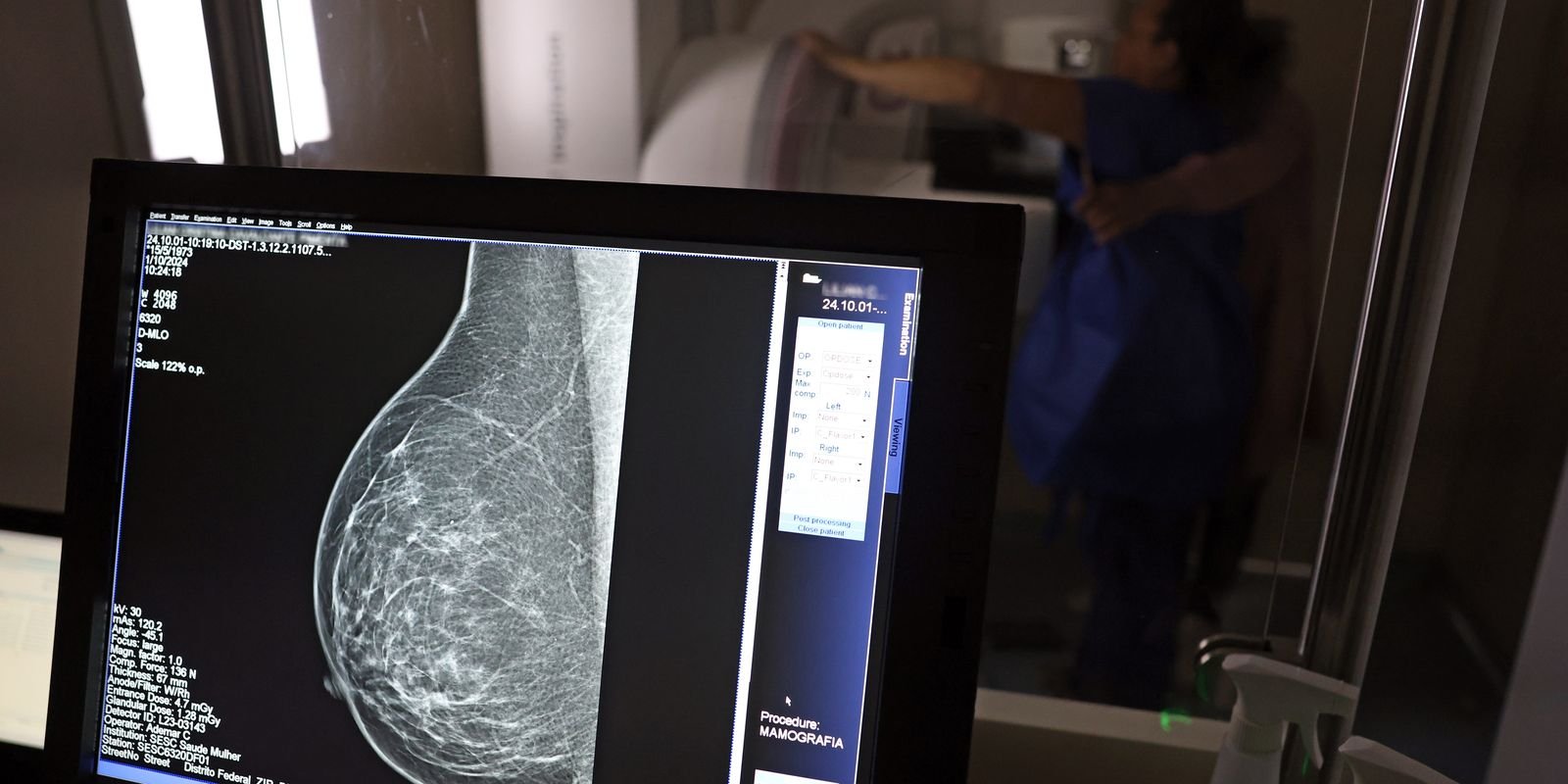 Câncer de mama: uma em cada três pacientes tem menos de 50 anos