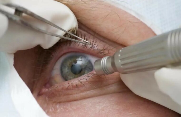 Cirurgia que altera cor do olho tem uso restrito para pessoas cegas