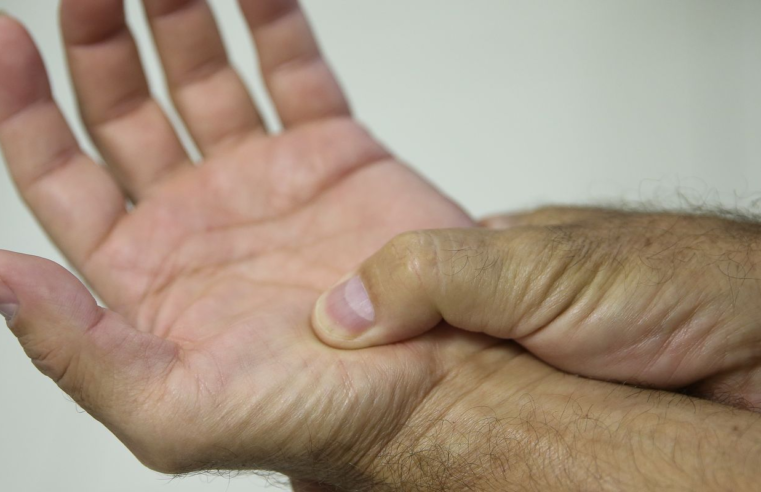 Lei define fibromialgia como deficiência em todo país a partir de 2026