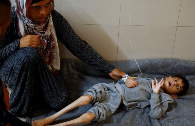 FAO aponta que fome chegou a pior patamar em Gaza