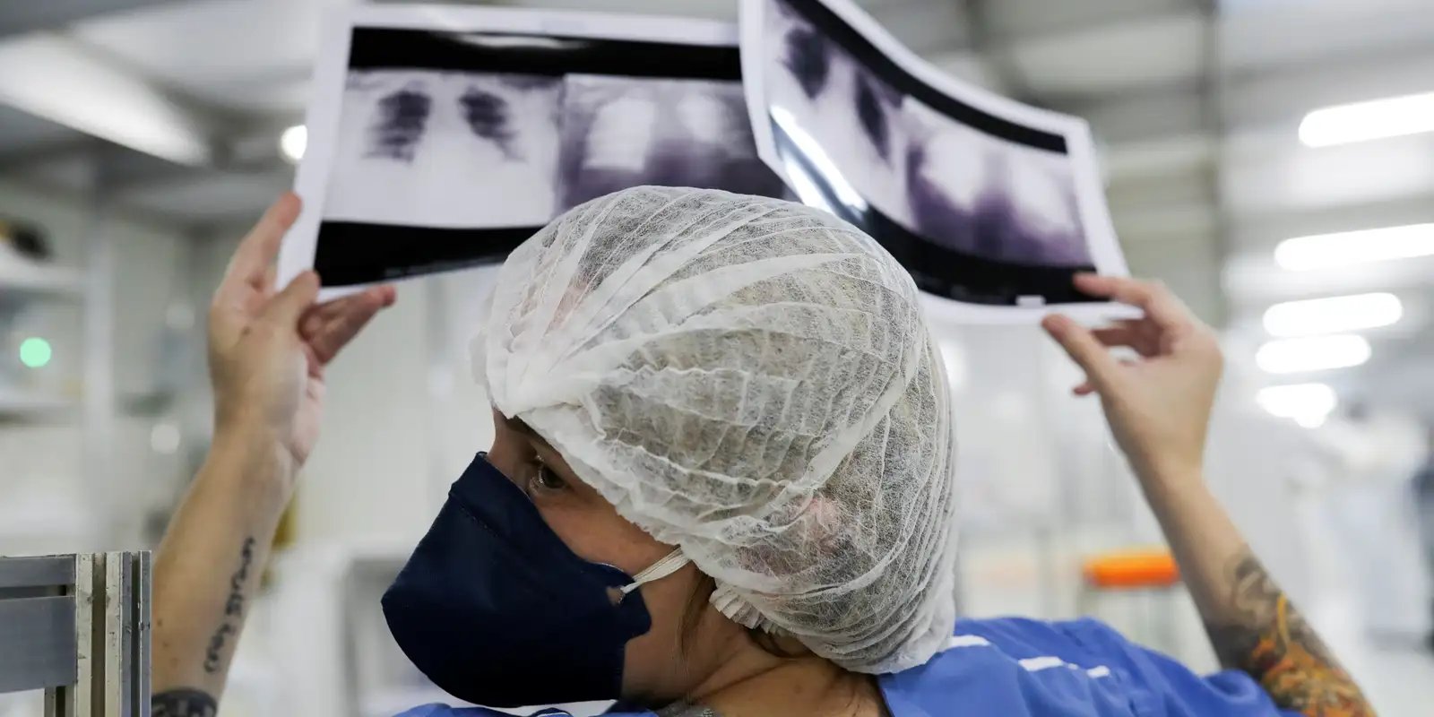 Câncer de pulmão: 15% dos casos acontecem em não fumantes