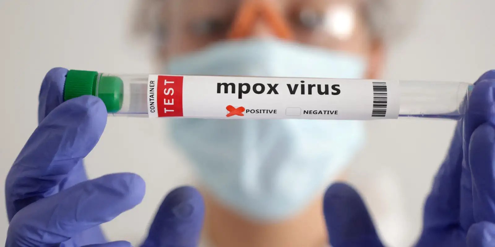 Mpox: África tem quase 50 mil casos confirmados