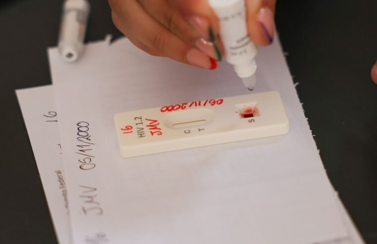 Ação no DF oferece testagem rápida e informação sobre HIV/Aids