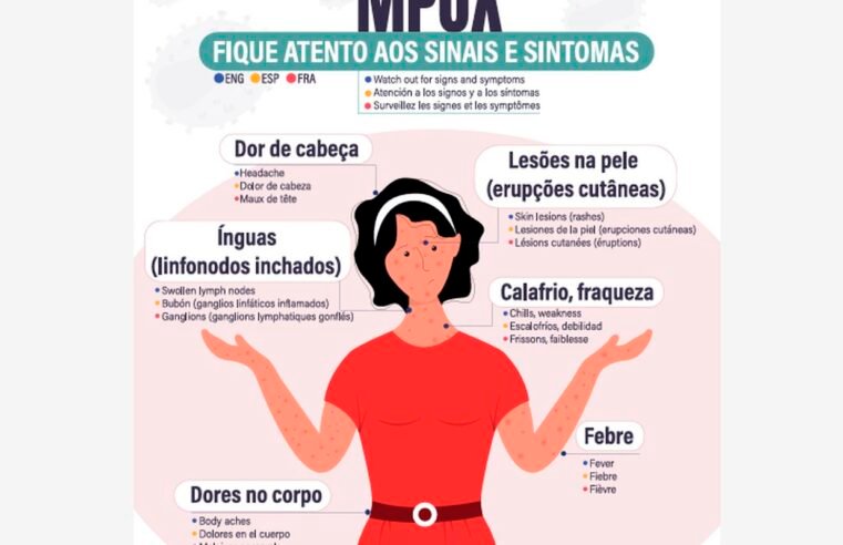 Secretaria de Saúde confirma segundo caso de mpox do grupo lp em SP