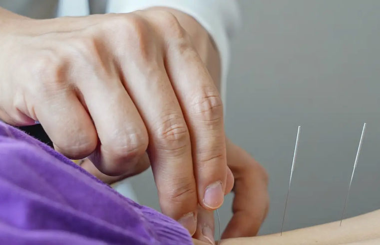 Brasil regulamenta exercício profissional da acupuntura