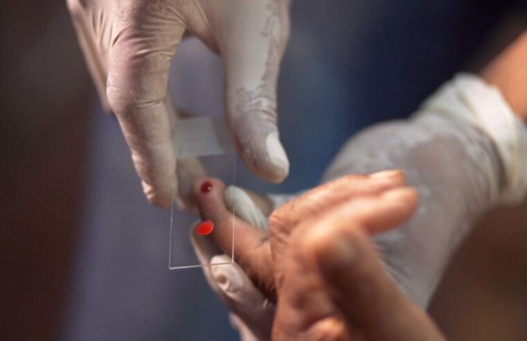 SUS começa a usar novo tratamento contra a malária em crianças